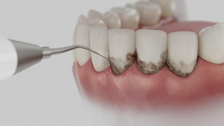Reliable Dental Implants contractor in Torrance, CA by Smile Center Dentistry